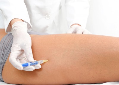 Mesoterapia